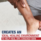 Healing Ointment in Kenya - Aquaphor Advanced Therapy,